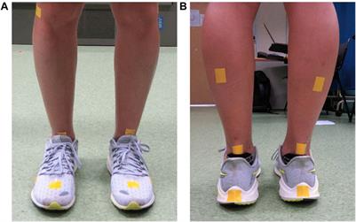 Crossover gait in running and measuring foot inversion angle at initial foot strike: a front-view <mark class="highlighted">video analysis</mark> approach